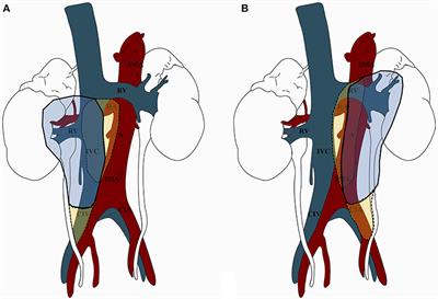 Templates of Lymph Node Dissection for Renal Cell Carcinoma: A Systematic Review of the Literature